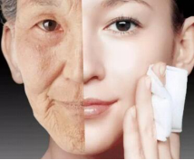 皮膚衰老,中藥,新陳代謝,調節(jié)內分泌,皮膚皺紋,抗氧化